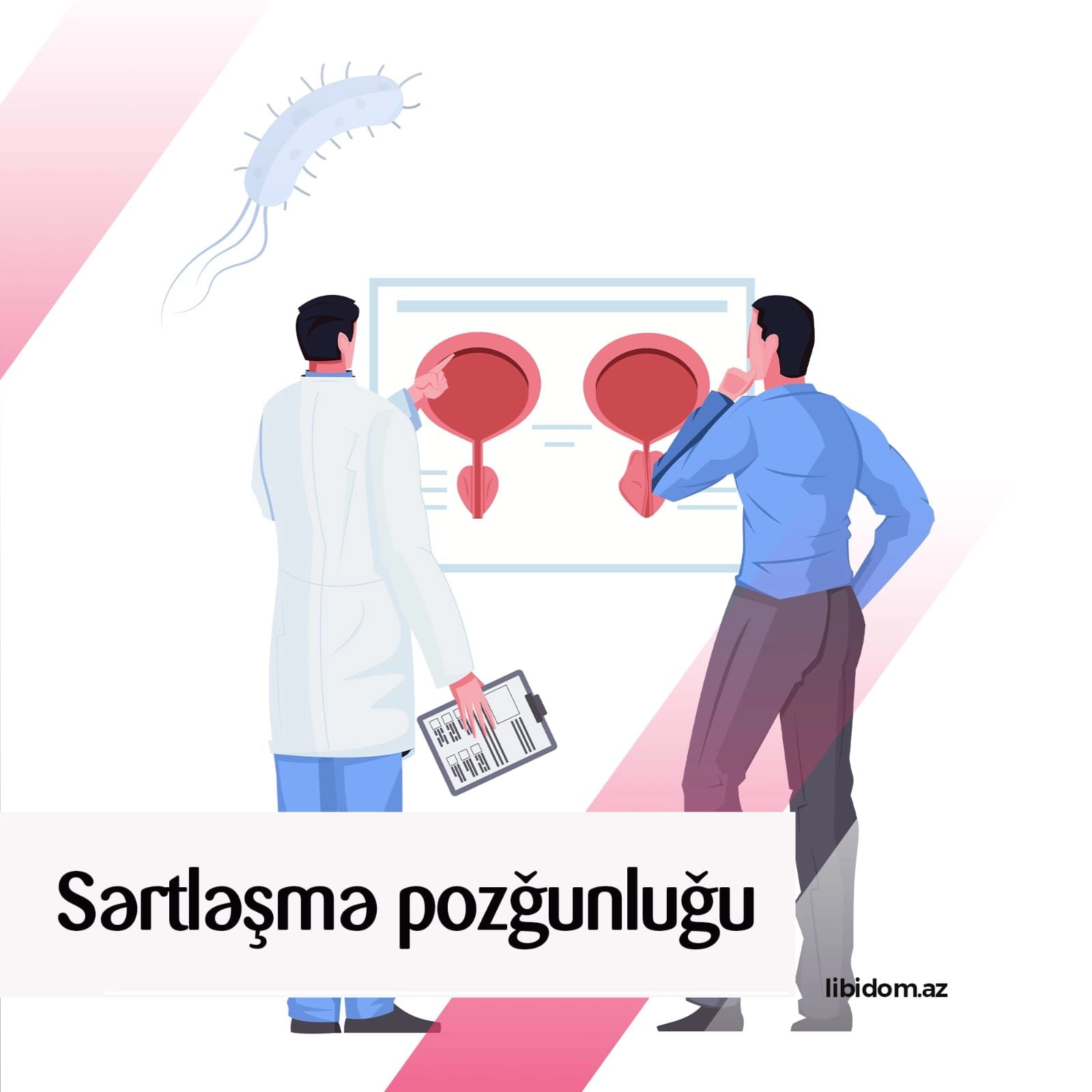 Sərtləşmə pozğunluğu